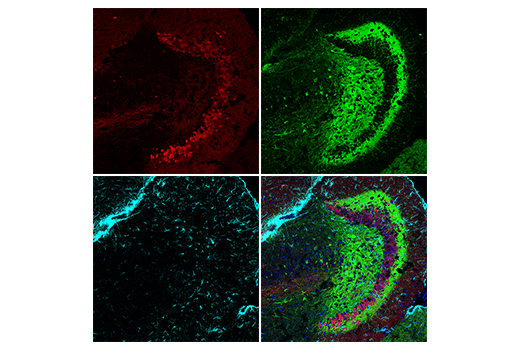 Immunofluorescence Image 2: Calretinin (E7R6O) XP<sup>®</sup> Rabbit mAb (BSA and Azide Free)