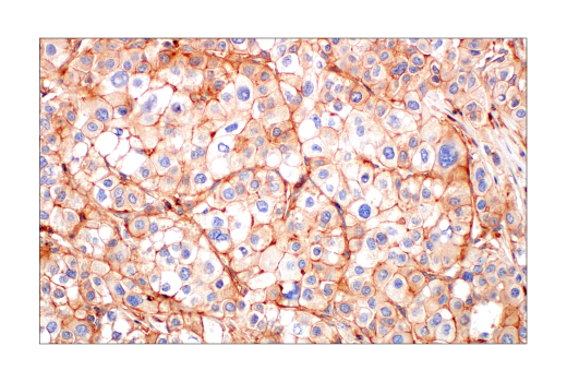 Immunohistochemistry Image 6: CMTM6 (E6A8T) Rabbit Monoclonal Antibody