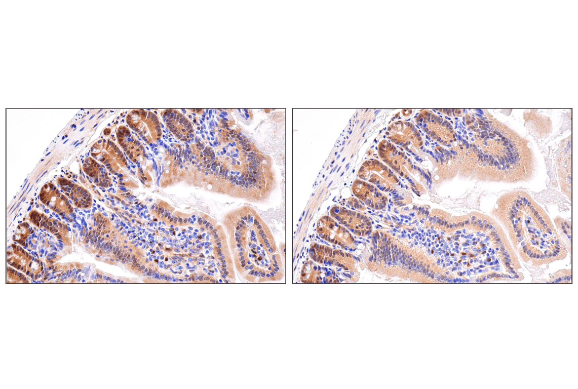 Immunohistochemistry Image 6: YAP (D8H1X) Rabbit Monoclonal Antibody