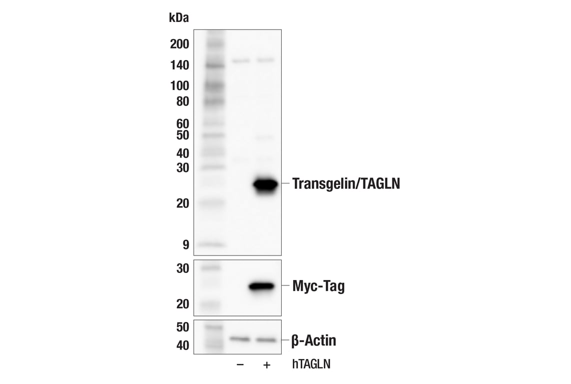 Western Blotting Image 2: Transgelin/TAGLN (F3B7H) Rabbit Monoclonal Antibody