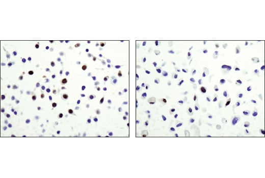 Immunohistochemistry Image 2: Wee1 (D10D2) Rabbit Monoclonal Antibody