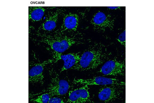 undefined Image 23: p62/KEAP1/NRF2 Pathway Antibody Sampler Kit