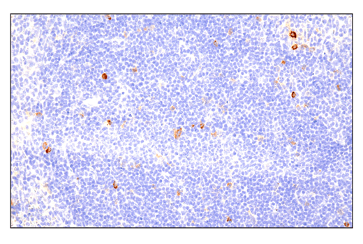 Immunohistochemistry Image 4: Phospho-SLP-76 (Ser376) (E3G9U) Rabbit Monoclonal Antibody