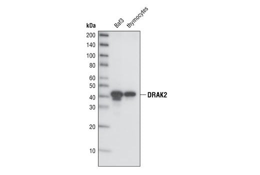 Western Blotting Image 1: DRAK2 (33D7) Rabbit mAb