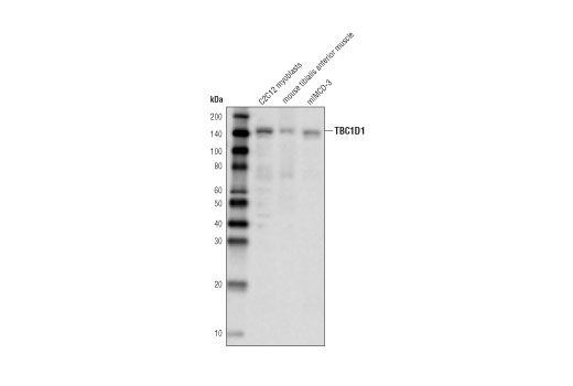 Western Blotting Image 1: TBC1D1 (D2Y8M) Rabbit mAb