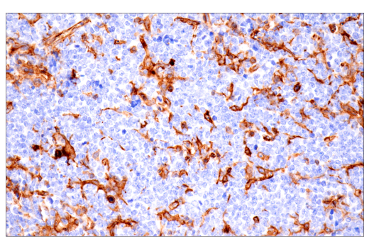 Immunohistochemistry Image 4: CD38 (E9F5A) Rabbit Monoclonal Antibody (BSA and Azide Free)
