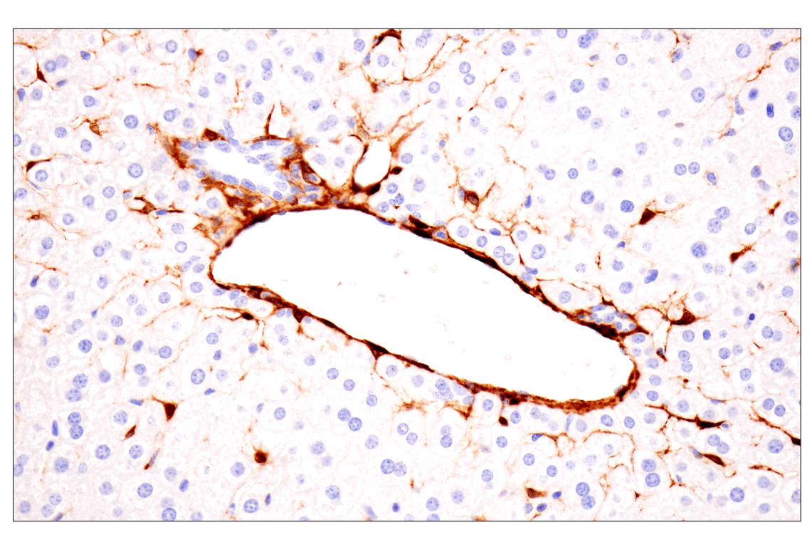 Immunohistochemistry Image 15: Transgelin/TAGLN (F3B7H) Rabbit Monoclonal Antibody