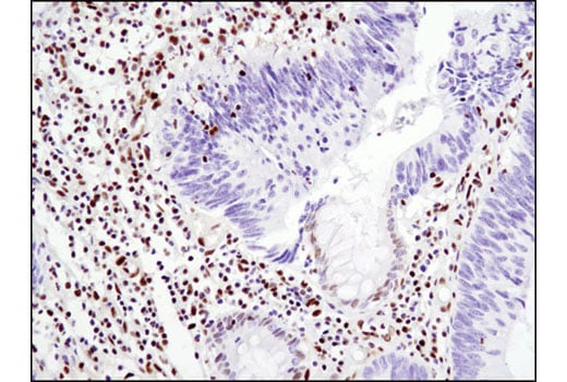 Immunohistochemistry Image 1: Glucocorticoid Receptor (D6H2L) Rabbit Monoclonal Antibody