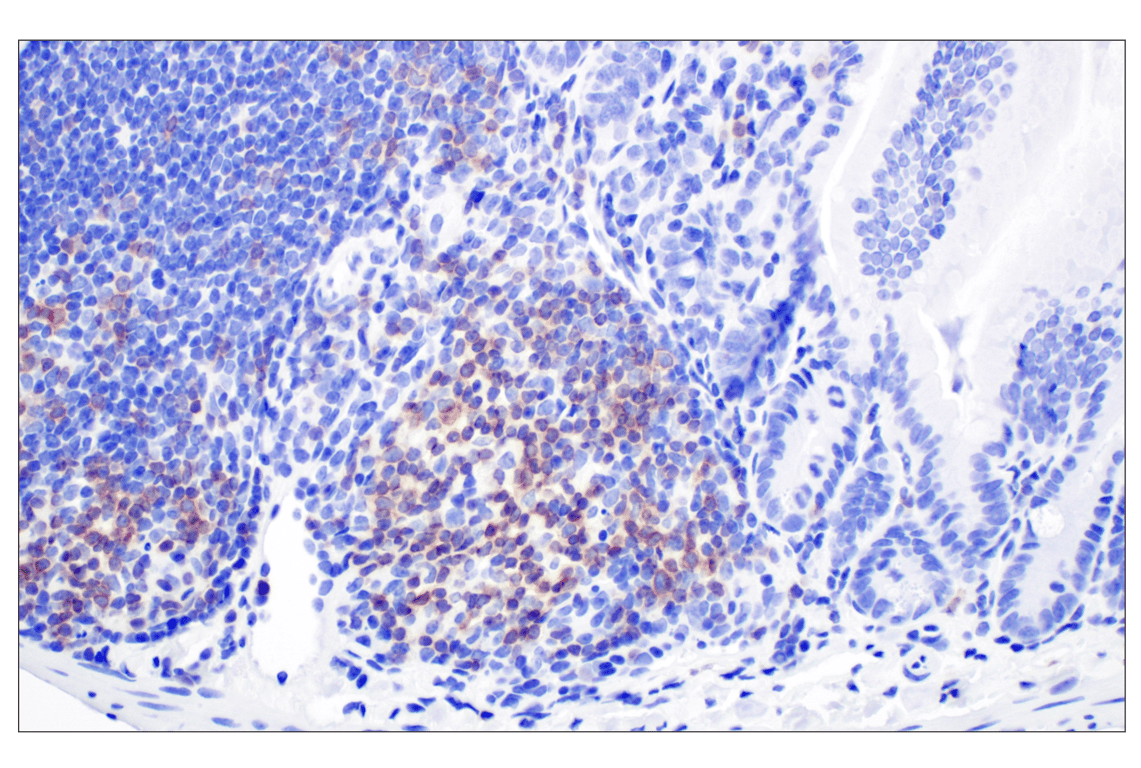 Immunohistochemistry Image 4: CD27 (F3R2V) Rabbit Monoclonal Antibody