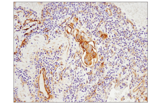 Immunohistochemistry Image 3: RhoB (D1J9V) Rabbit Monoclonal Antibody