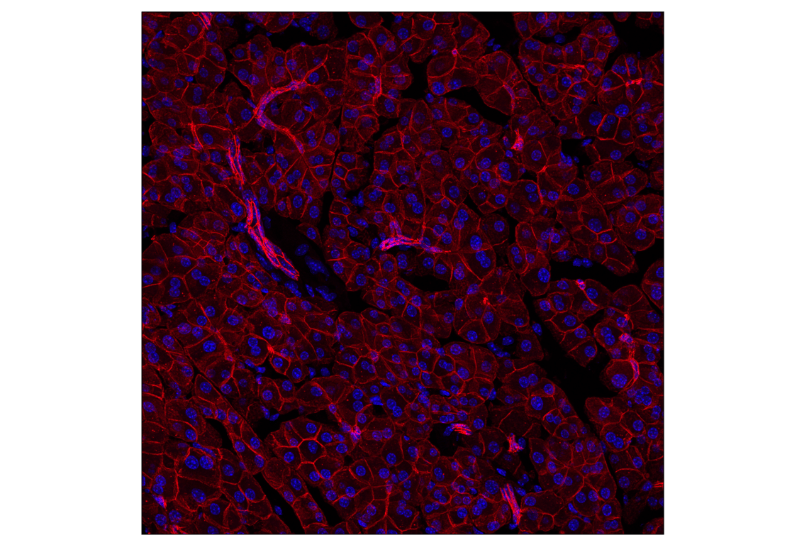 Immunofluorescence Image 2: E-Cadherin (24E10) Rabbit Monoclonal Antibody (Alexa Fluor<sup>®</sup> 594 Conjugate)