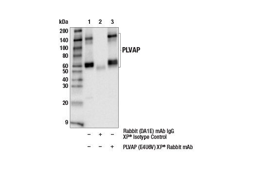 Immunoprecipitation Image 1: PLVAP (E4U6V) Rabbit Monoclonal Antibody