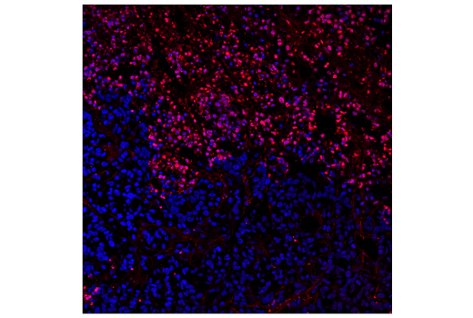 Immunohistochemistry Image 2: TUNEL Assay Kit (Fluorescence, 640 nm)