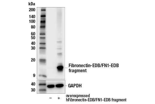 Western Blotting Image 1: Fibronectin-EDB/FN1-EDB (E8J3Z) Rabbit mAb