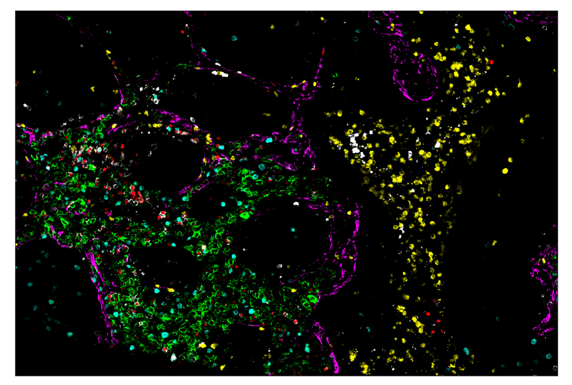 Immunohistochemistry Image 1: CD19 (Intracellular Domain) (D4V4B) & CO-0054-750 SignalStar<sup>™</sup> Oligo-Antibody Pair