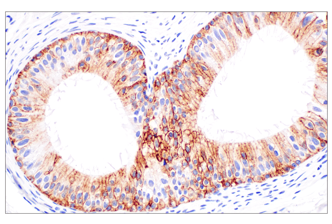 Immunohistochemistry Image 9: TACSTD2/TROP2 (F4W4J) Rabbit Monoclonal Antibody