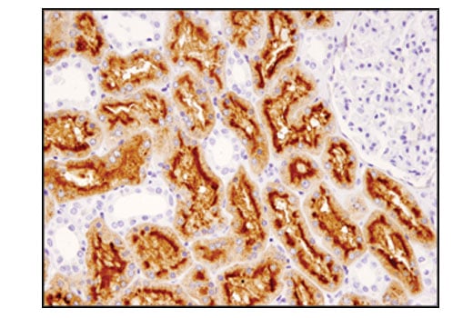 Immunohistochemistry Image 3: DPP4/CD26 (D6D8K) Rabbit Monoclonal Antibody (IHC Formulated)
