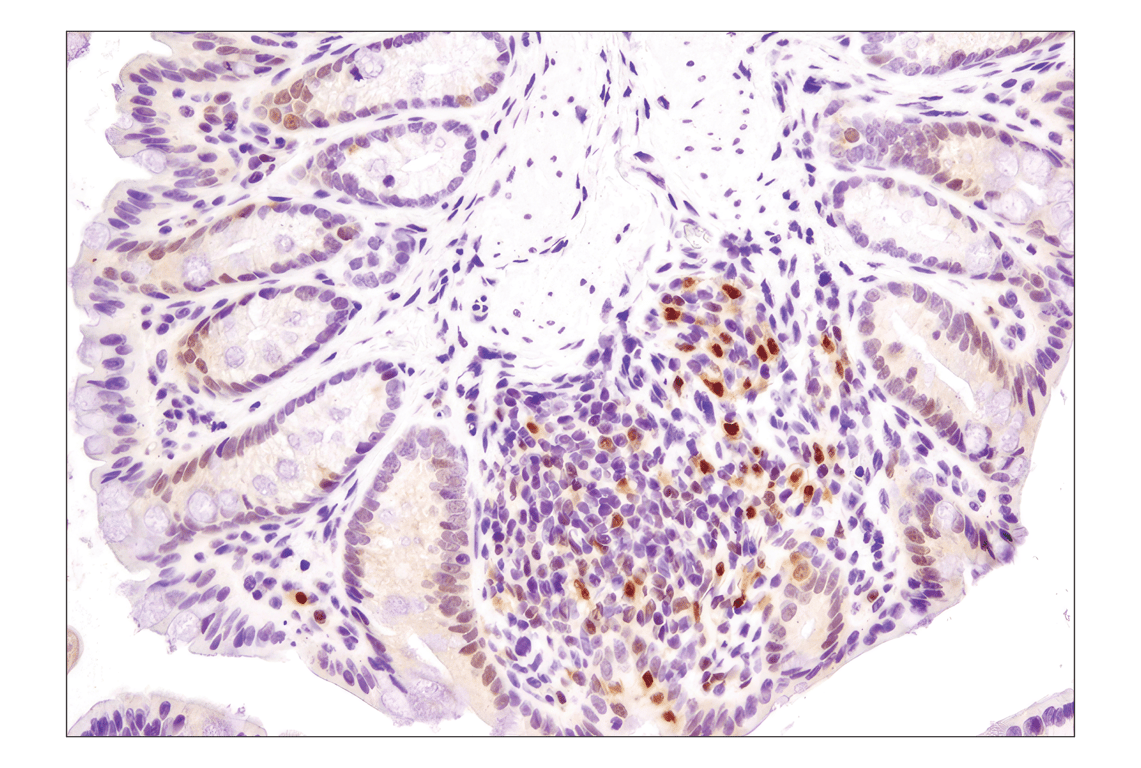 undefined Image 17: Angiogenesis Antibody Sampler Kit