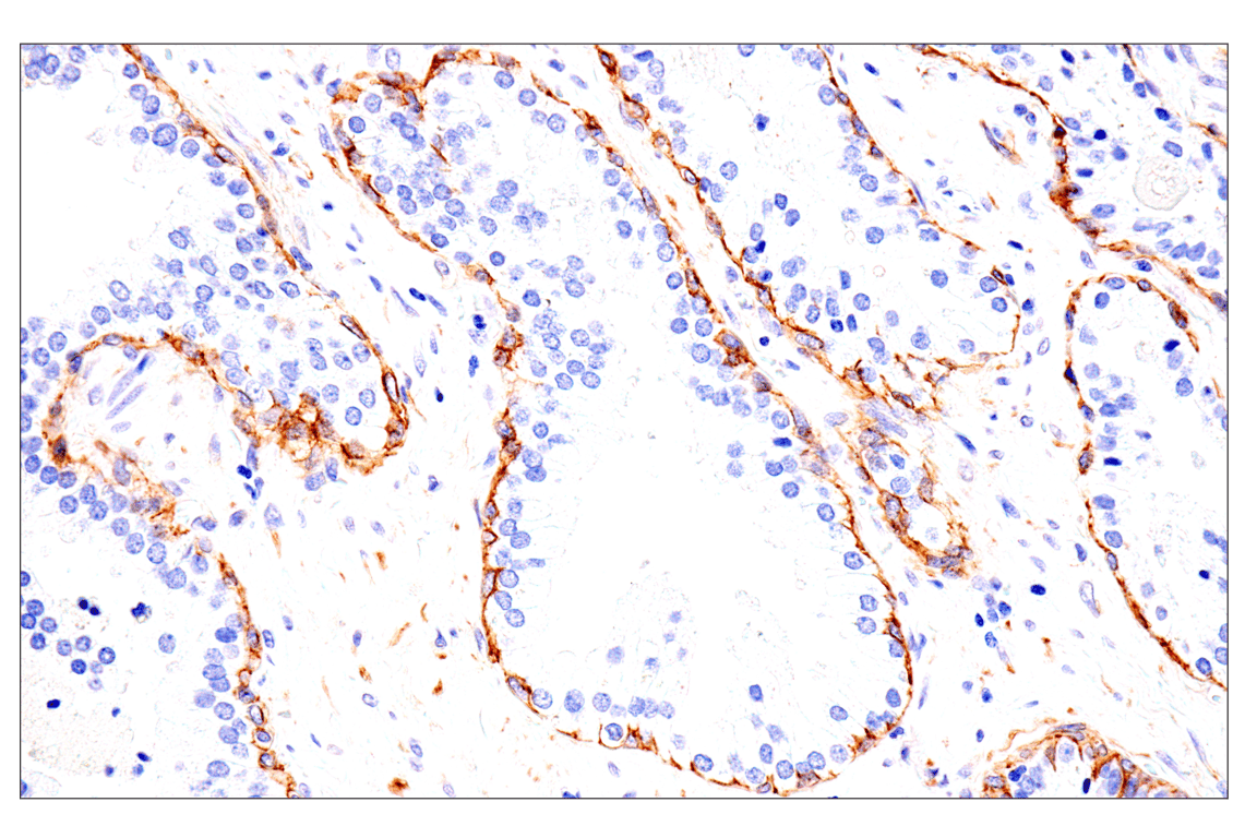 Immunohistochemistry Image 2: p75NTR (E7I3M) Rabbit Monoclonal Antibody (BSA and Azide Free)