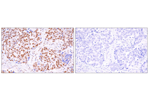 Immunohistochemistry Image 3: BRD4 (E2A7X) Rabbit Monoclonal Antibody