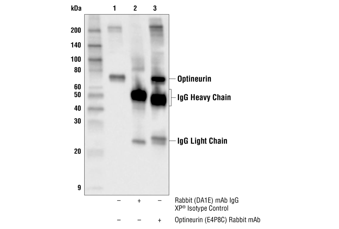 undefined Image 6: PhosphoPlus<sup>®</sup> Optineurin (Ser177) Antibody Duet