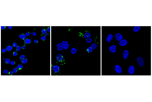 Immunofluorescence Image 1: IL-2R gamma (E1V1O) Rabbit Monoclonal Antibody