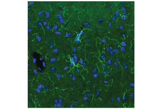 Immunofluorescence Image 1: Coronin 1A (D6K5B) XP<sup>®</sup> Rabbit mAb