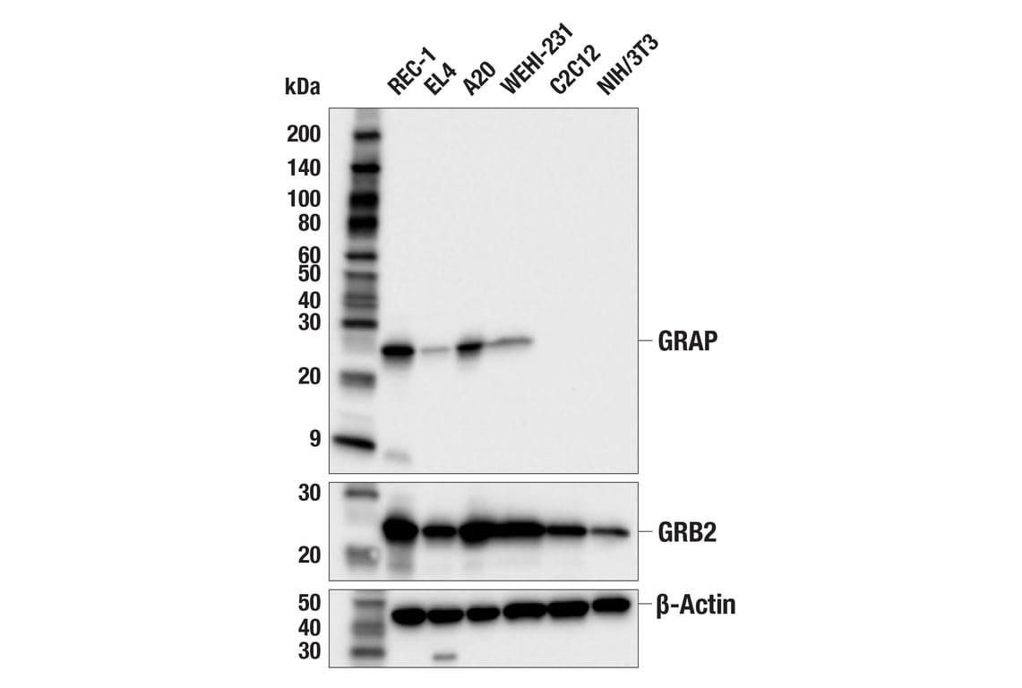 Western Blotting Image 2: GRAP (F9U7T) Rabbit Monoclonal Antibody