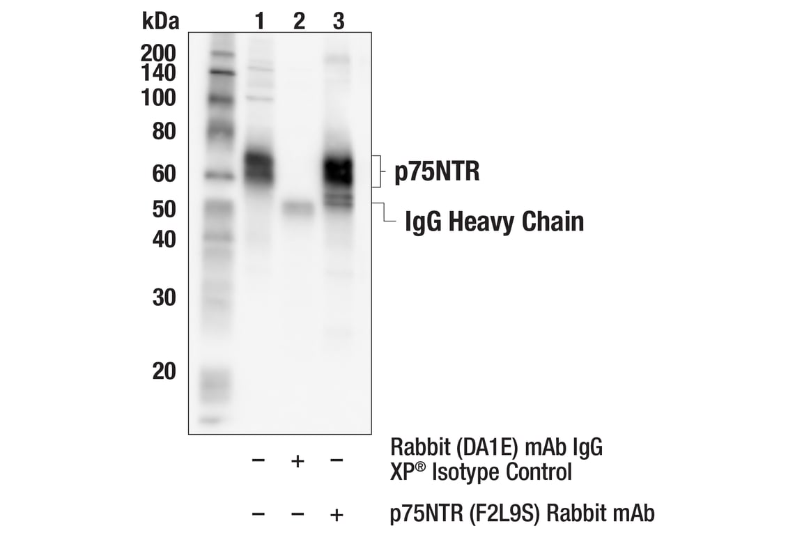 Immunoprecipitation Image 1: p75NTR (F2L9S) Rabbit Monoclonal Antibody