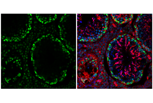 Immunofluorescence Image 3: NSUN2 (E6N6I) Rabbit Monoclonal Antibody