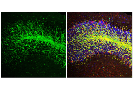 Immunofluorescence Image 3: NDRG1 (E2T5I) Rabbit Monoclonal Antibody