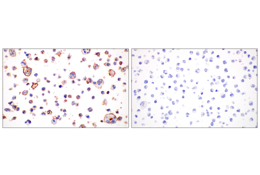 Immunohistochemistry Image 5: CD2 (D6V9F) Rabbit Monoclonal Antibody (BSA and Azide Free)