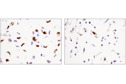 Immunohistochemistry Image 3: FoxM1 (D3F2B) Rabbit Monoclonal Antibody