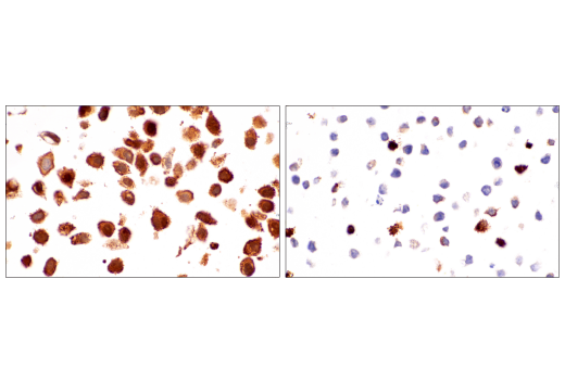 undefined Image 38: Ferroptosis Antibody Sampler Kit