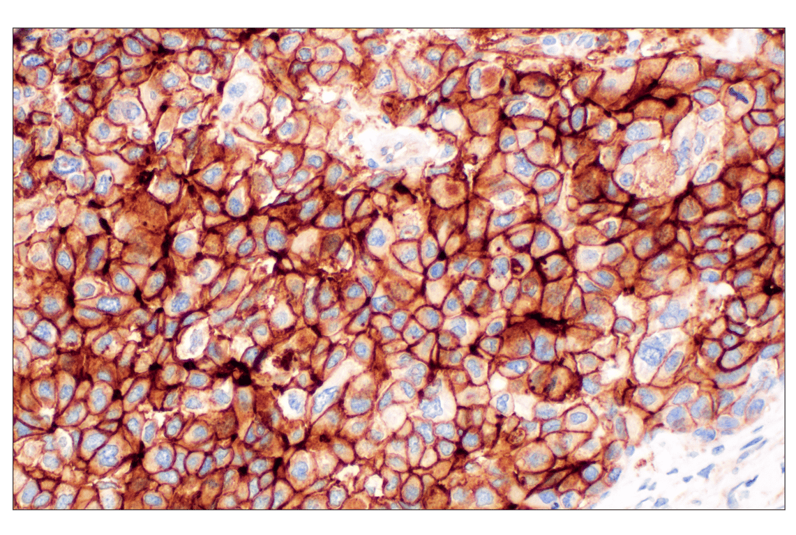 Immunohistochemistry Image 1: NT5E/CD73 (D7F9A) Rabbit Monoclonal Antibody