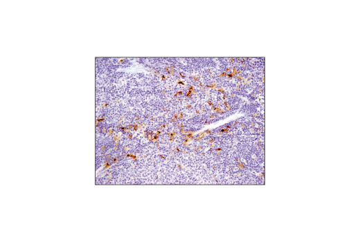 Immunohistochemistry Image 2: TIM-3 (D3M9R) Rabbit Monoclonal Antibody