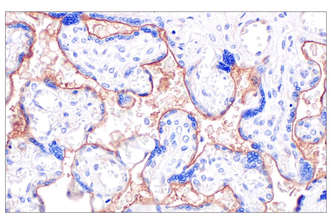 Immunohistochemistry Image 4: CD105/Endoglin (F9C5Q) Rabbit Monoclonal Antibody