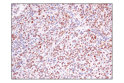 Immunohistochemistry Image 6: Ape1 (E5Y2C) Rabbit Monoclonal Antibody