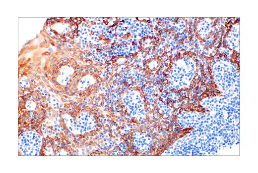 Immunohistochemistry Image 5: Keratin 14 (LL002) Mouse Monoclonal Antibody
