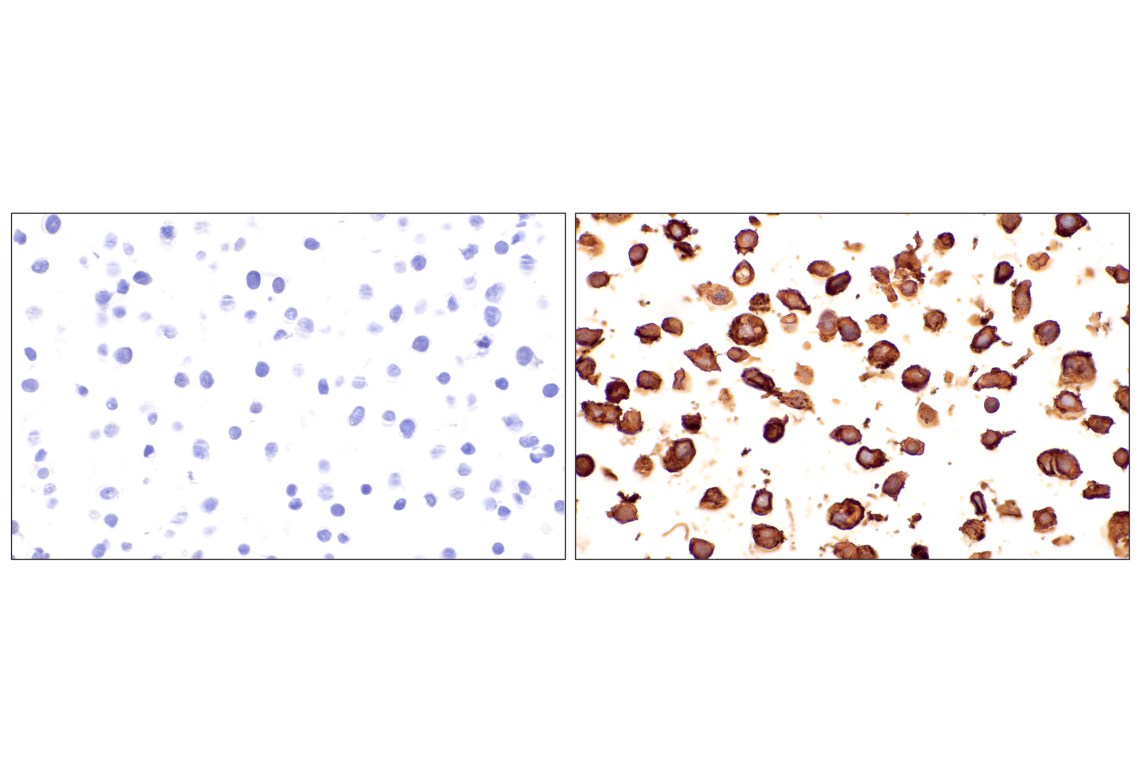 Immunohistochemistry Image 16: EMCN (E3Z4D) Rabbit Monoclonal Antibody
