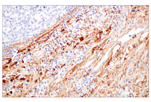 Immunohistochemistry Image 5: COL14A1 (E5W8S) Rabbit Monoclonal Antibody