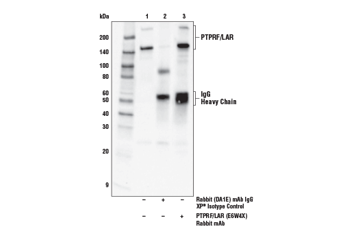Immunoprecipitation Image 1: PTPRF/LAR (E6W4X) Rabbit Monoclonal Antibody