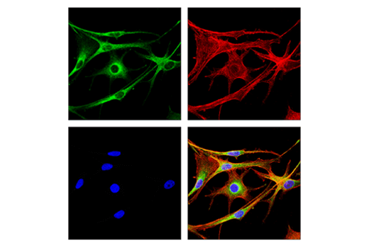 Immunofluorescence Image 1: Rab7 (E9O7E) Mouse Monoclonal Antibody