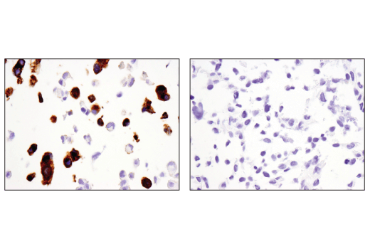 Immunohistochemistry Image 1: Synaptophysin (D8F6H) Rabbit Monoclonal Antibody (BSA and Azide Free)