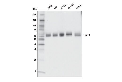 Western Blotting Image 1: E2F4 (E3G2G) Rabbit mAb