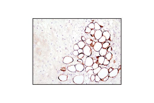 Immunohistochemistry Image 4: Fatty Acid Synthase (C20G5) Rabbit Monoclonal Antibody