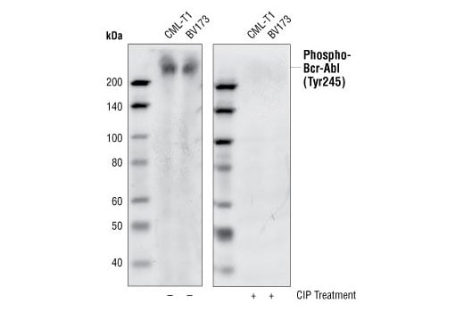 Western Blotting Image 2: Phospho-c-Abl (Tyr245) (73E5) Rabbit Monoclonal Antibody
