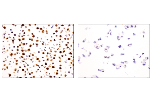 Immunohistochemistry Image 1: Syk (4D10) Mouse Monoclonal Antibody