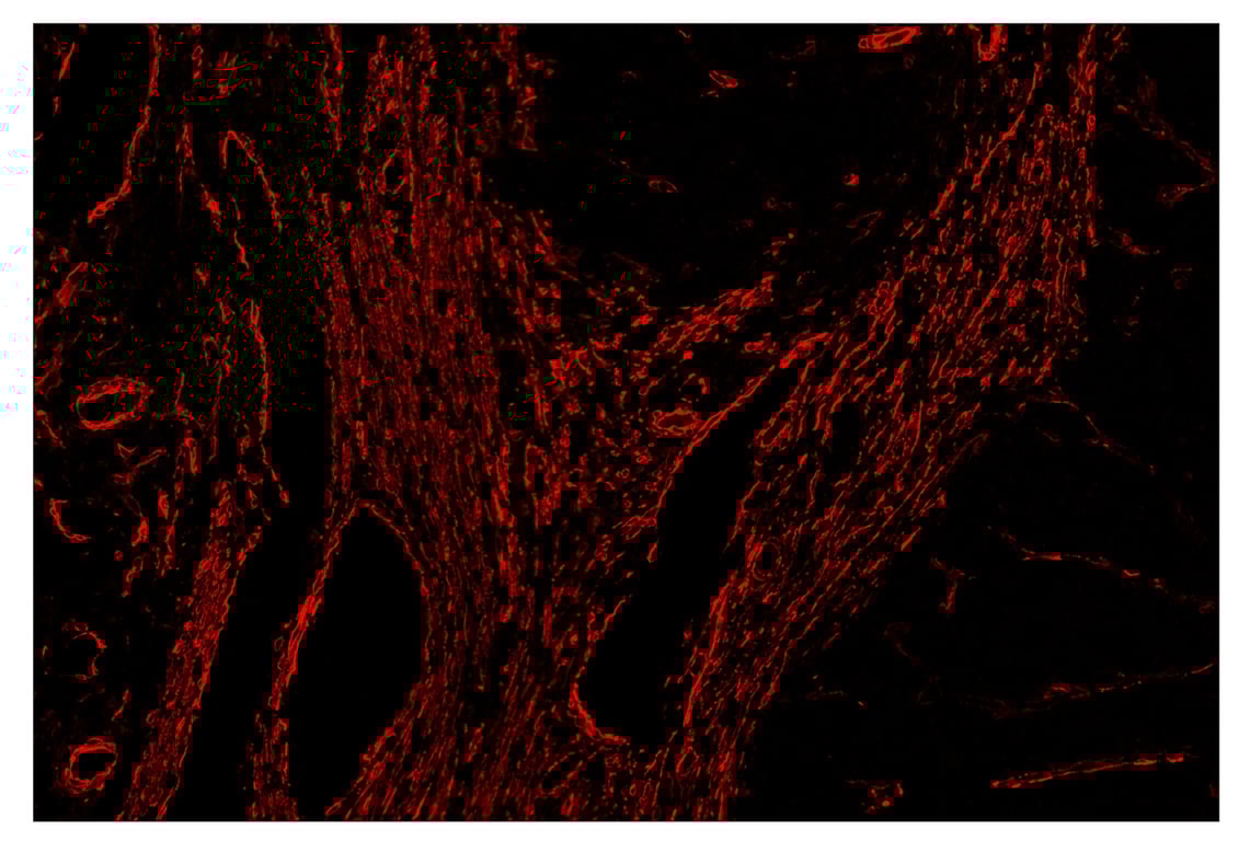 Immunohistochemistry Image 5: alpha-Smooth Muscle Actin (D4K9N) & CO-0024-488 SignalStar<sup>™</sup> Oligo-Antibody Pair