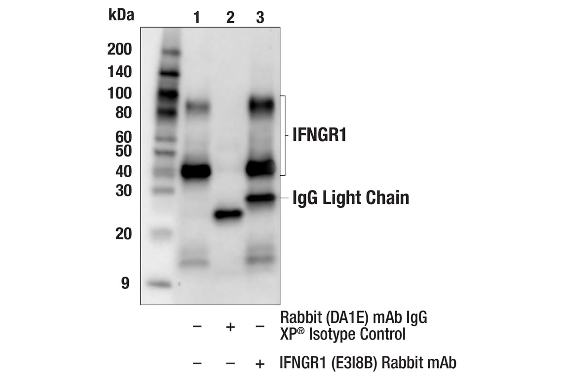 Immunoprecipitation Image 1: IFNGR1 (E3I8B) Rabbit Monoclonal Antibody